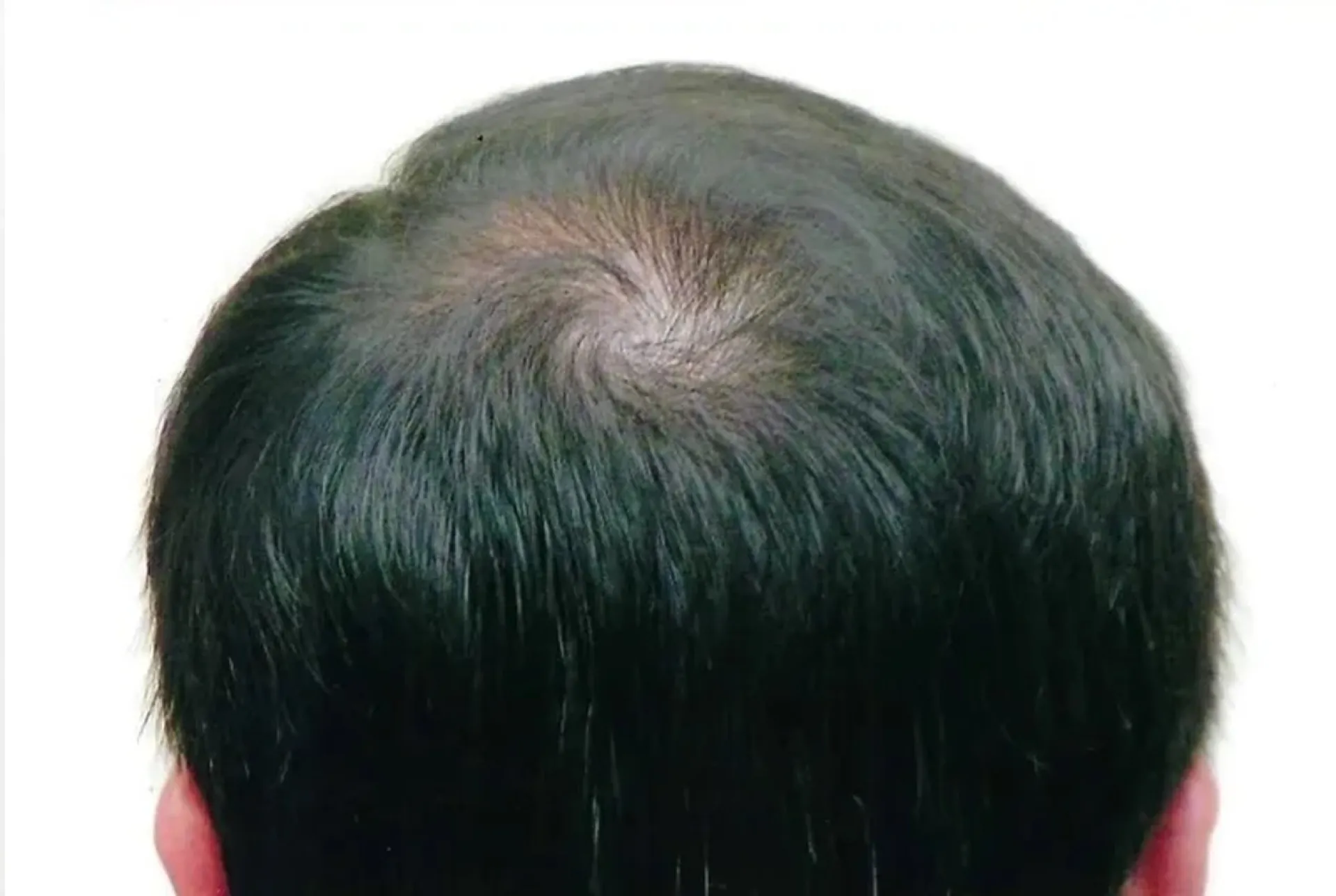 After treatment 2