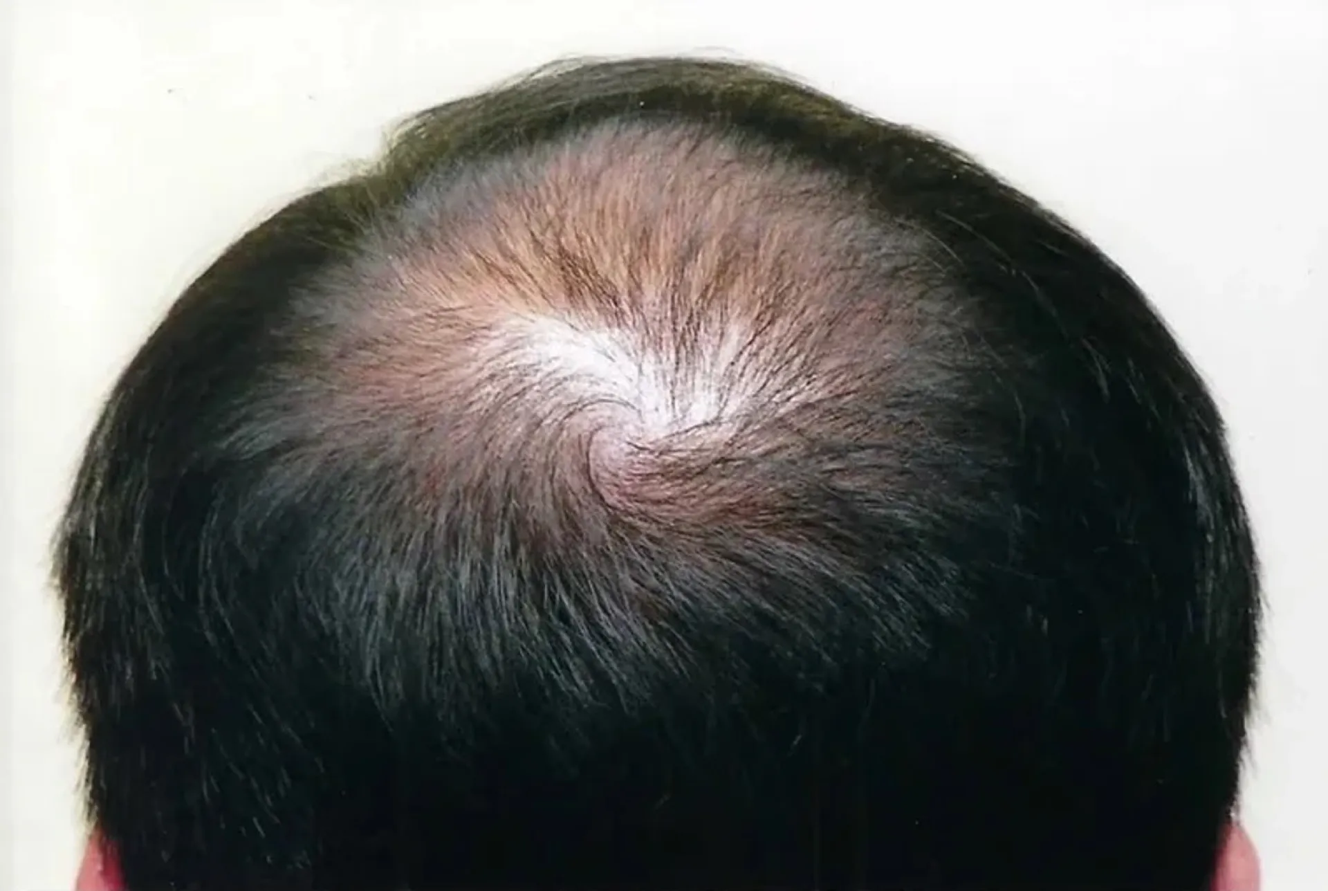 Before treatment 2