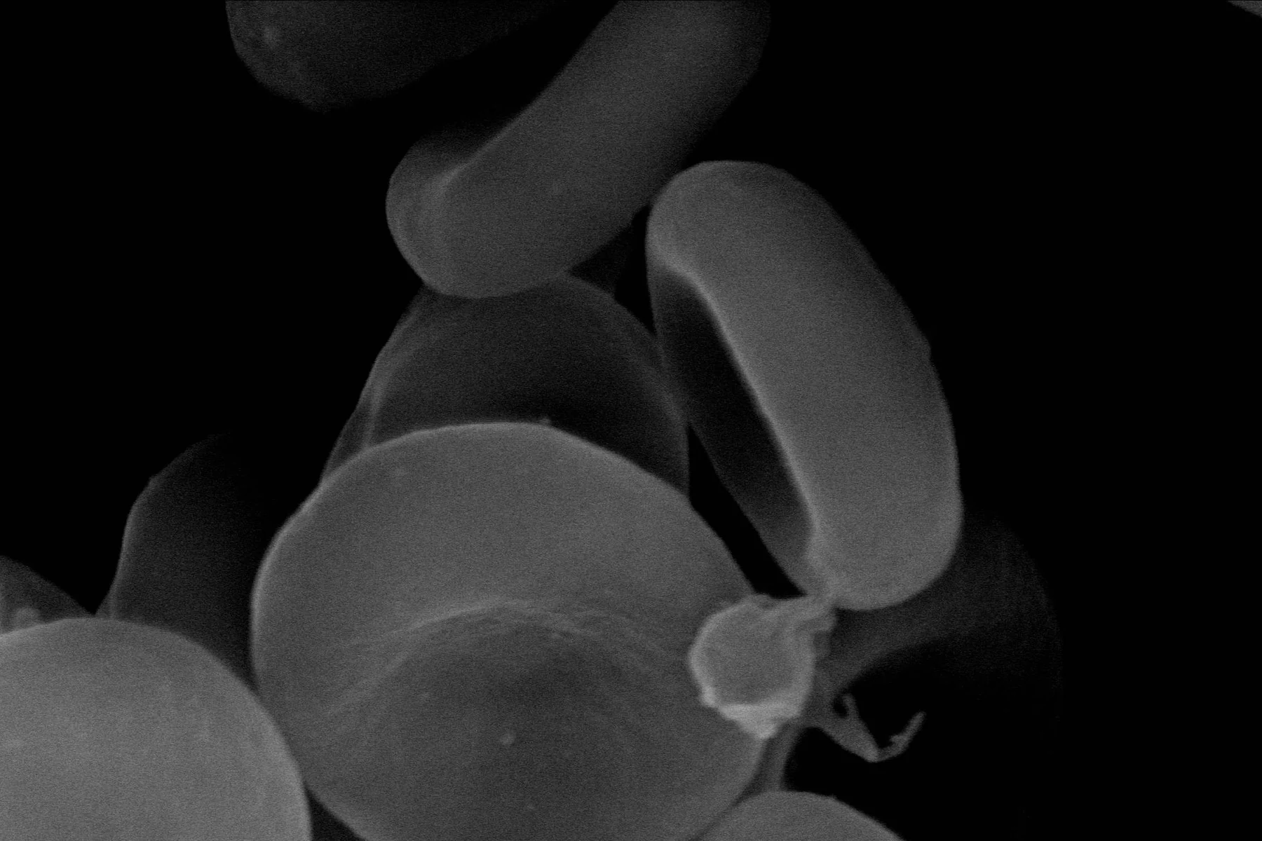 A real scanning electron micrograph shows red blood cells.