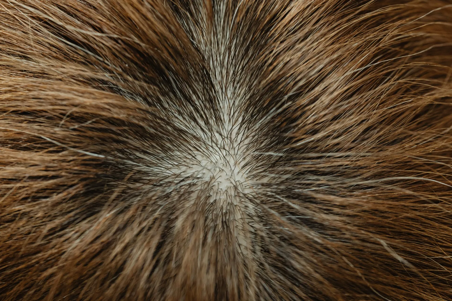Hair Growth Treatment results