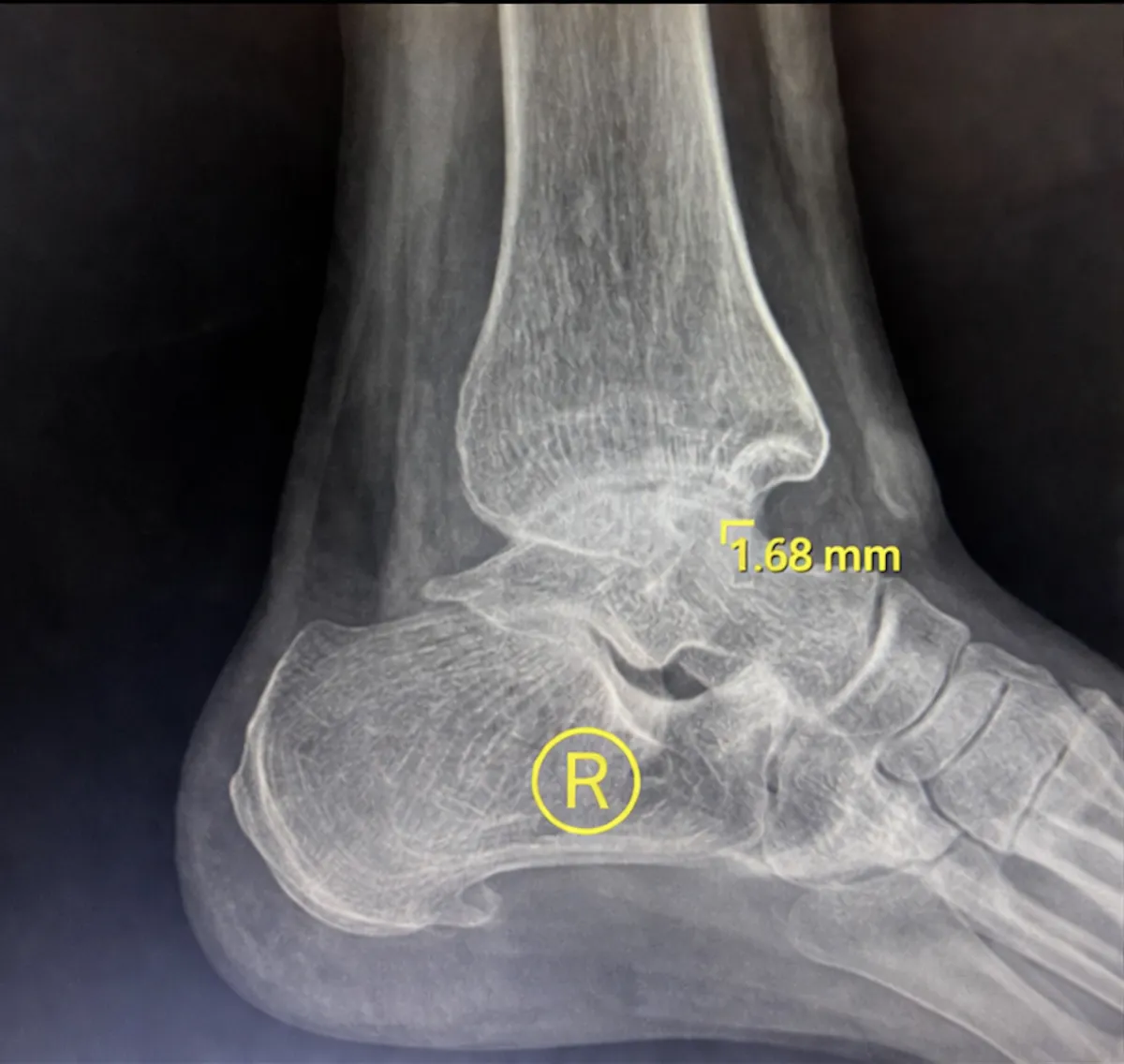 Before treatment 2