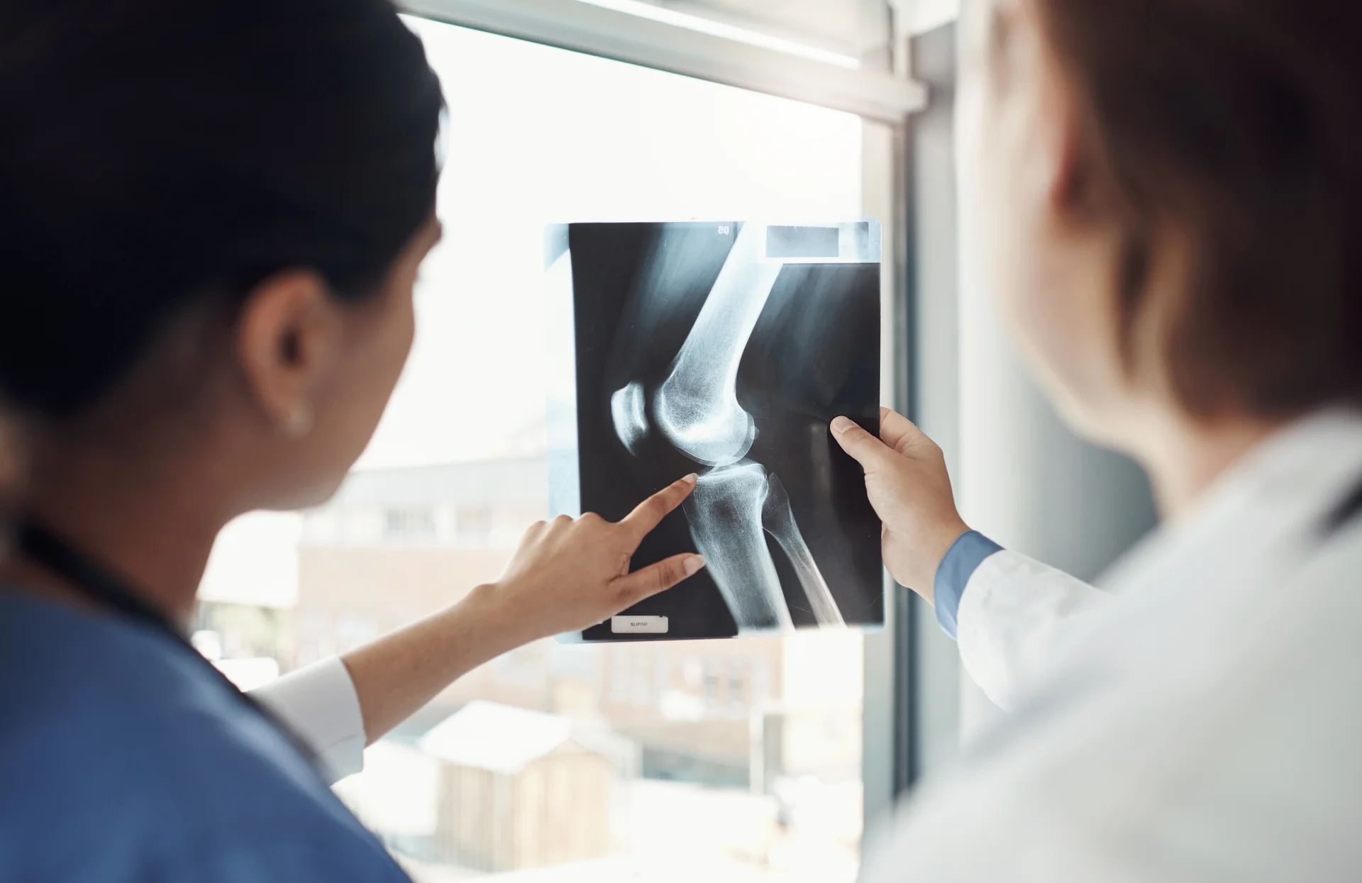 Non-Surgical Approach