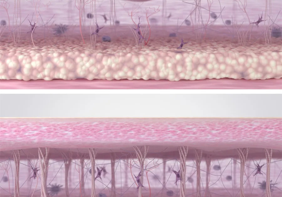 Texture and Tone Improvement
