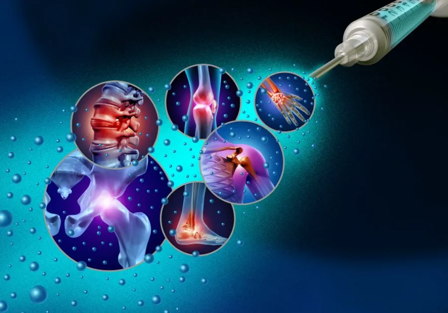 Medical illustration of a syringe and regenerative treatment areas across the spine and major joints