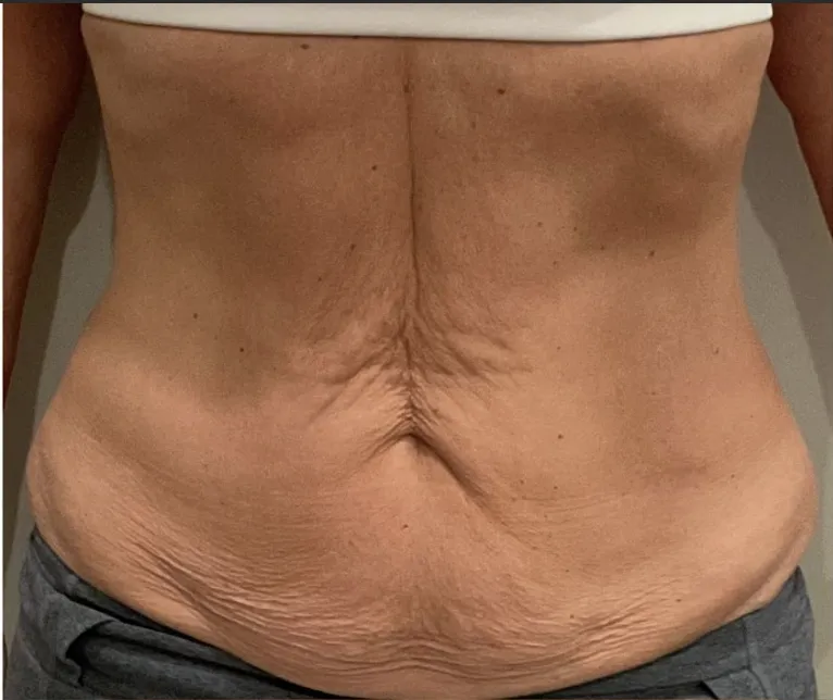 Before treatment 2