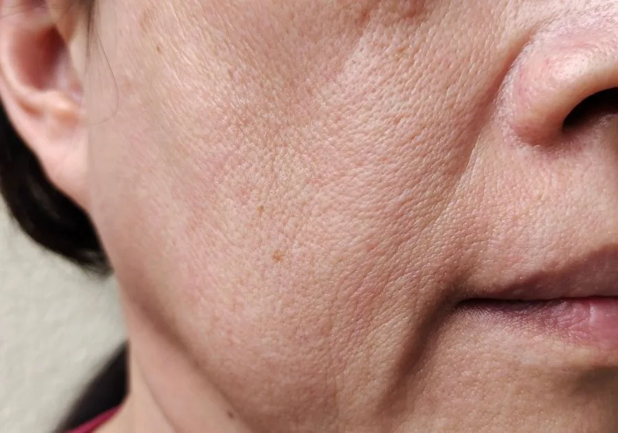 Skin laxity and facial firming consultation at a Regen & Restore medical clinic