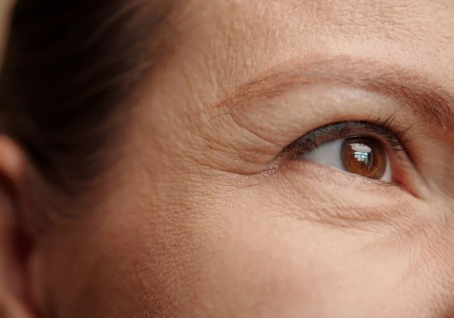 Facial fine line and skin aging assessment for anti-aging skin rejuvenation